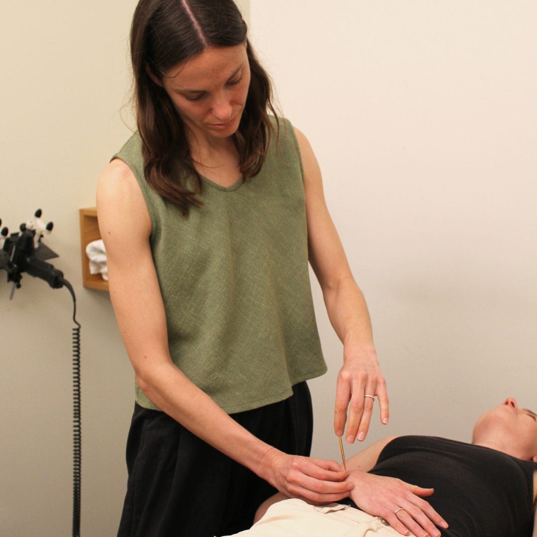 Toyohari Japanese acupuncture at Selph
