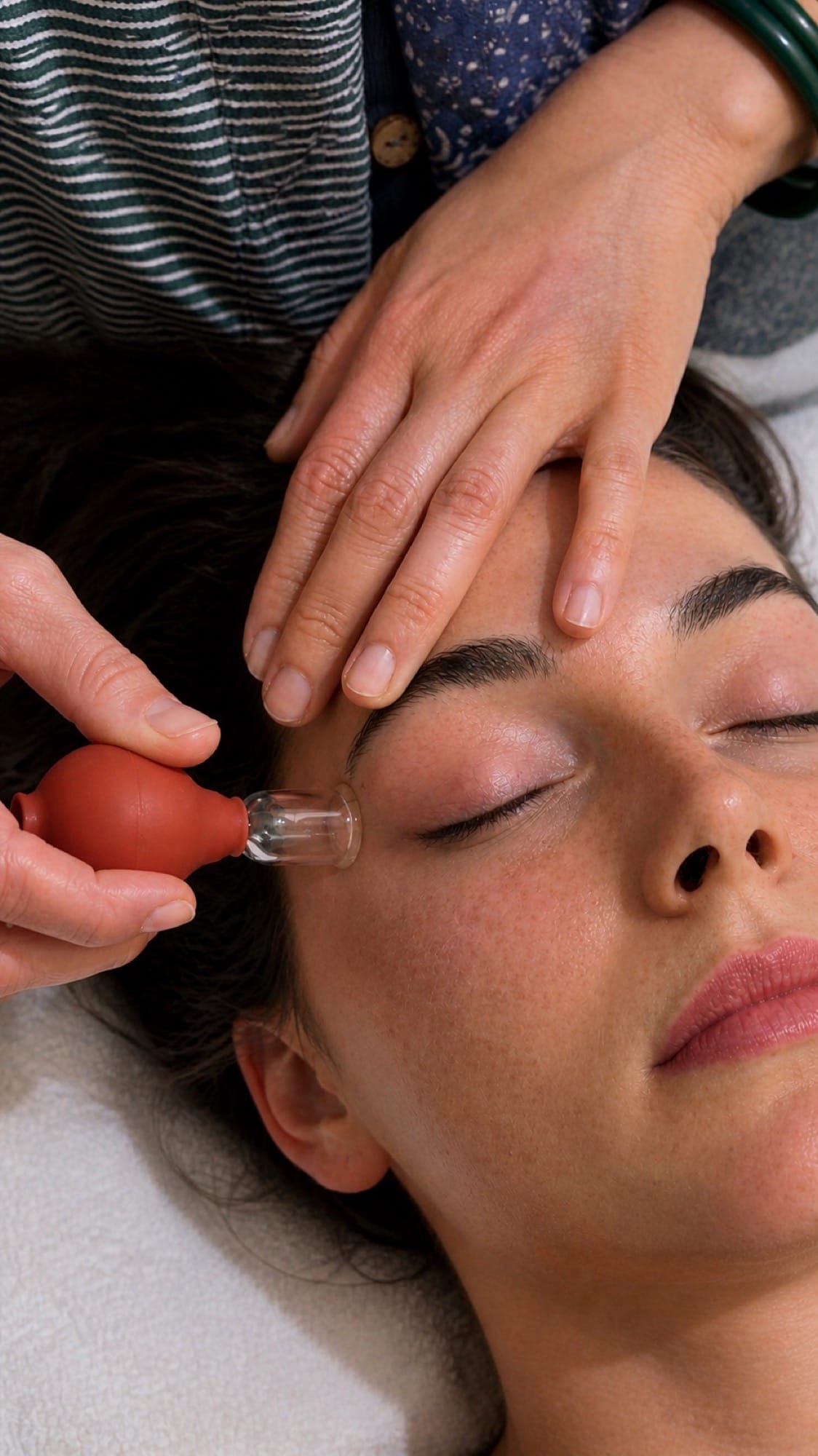Cosmetic Facial Acupuncture